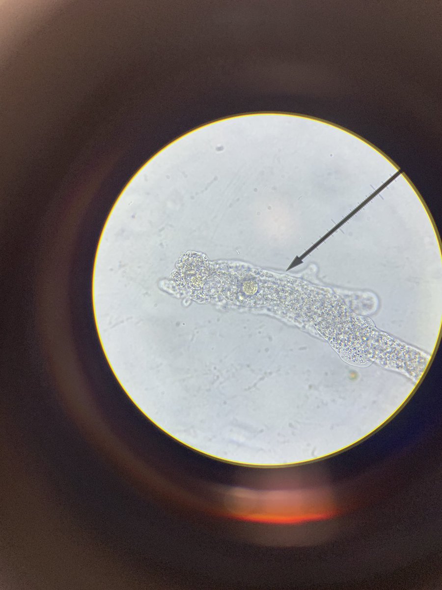 Kicking off our cell unit by looking at live single celled organisms. Students loved seeing firsthand the cytoplasmic streaming of an amoeba! #WEareLakota #theEASTway