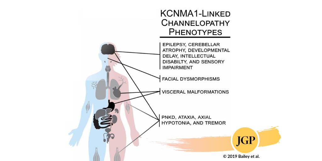 JGenPhysiol's tweet image. #Neurologists &amp;amp; patients interested in Kamiyah’s story from @Netflix @NYTMag series #Diagnosis can find more information about KCNMA1-linked channelopathy in this review article by Andrea L Meredith (@BKChannels of @UMmedschool) et al.: bit.ly/2HerNJA