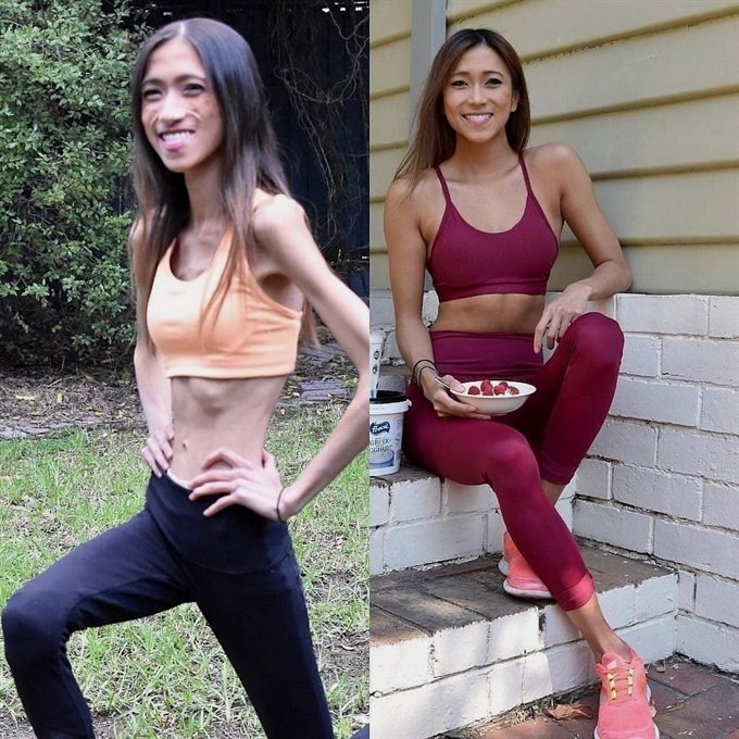 ketoz4's tweet photo. Amazing transformation from 👏🏻👏🏻👏🏻
"The difference between eating to survive and eating to thrive 🌟🥗🍩
.
#keto #ketogenic #ketorecipes #ketorecipe #ketolifestyle #ketojourney #ketodiet #ketogenicdiet #ketogeniclifestyle #ketoforlife #ketomeals #ketofoods #ketofood https://t.co/Vv9GxfiCMp