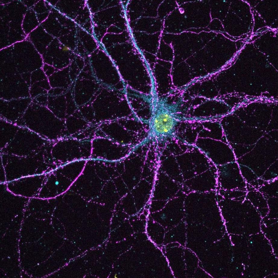 ecutterflower's tweet image. #depdc5 in blue, #synapsin in purple, #DAPI in yellow
#galaxy #neuroscience #neuron #confocal #leica #science