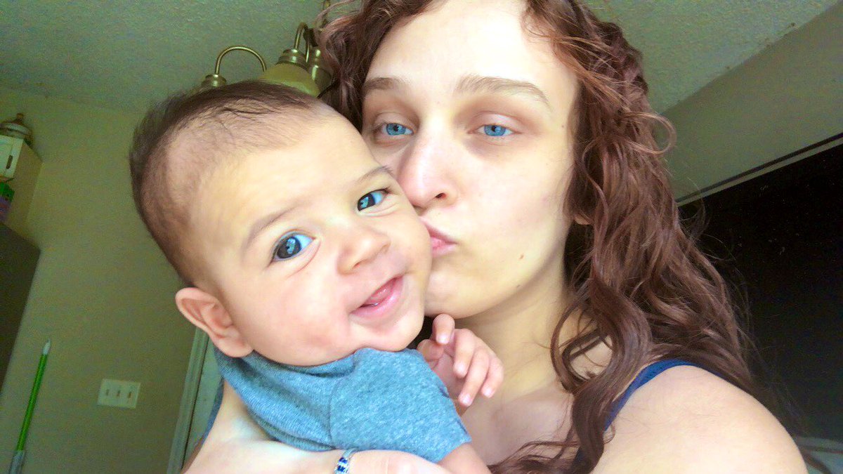 Lopsided head havin ass🥰