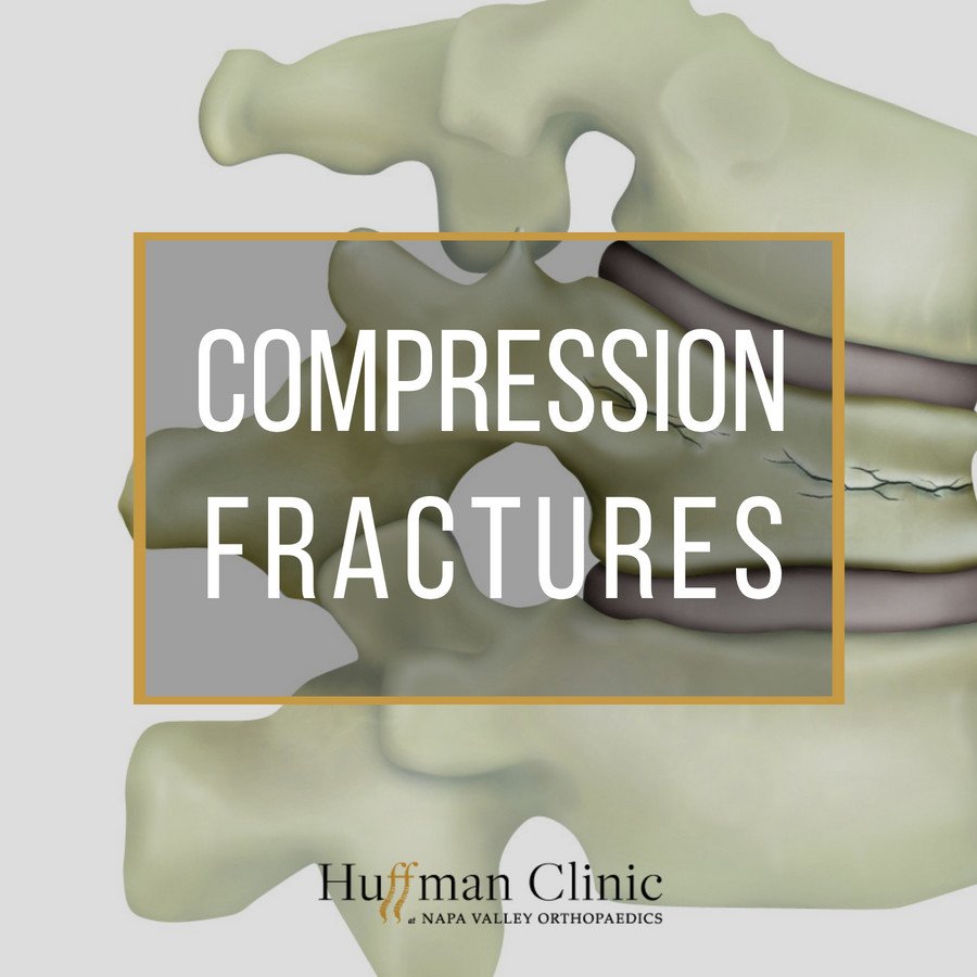 HuffmanClinic's tweet photo. What are #CompressionFractures and how do you treat them? Find out everything you need to know: https://t.co/uvuCwyflH2
#fracture #vertebrae #spine #spinesurgery #kyphoplasty https://t.co/3ikHaknC7G