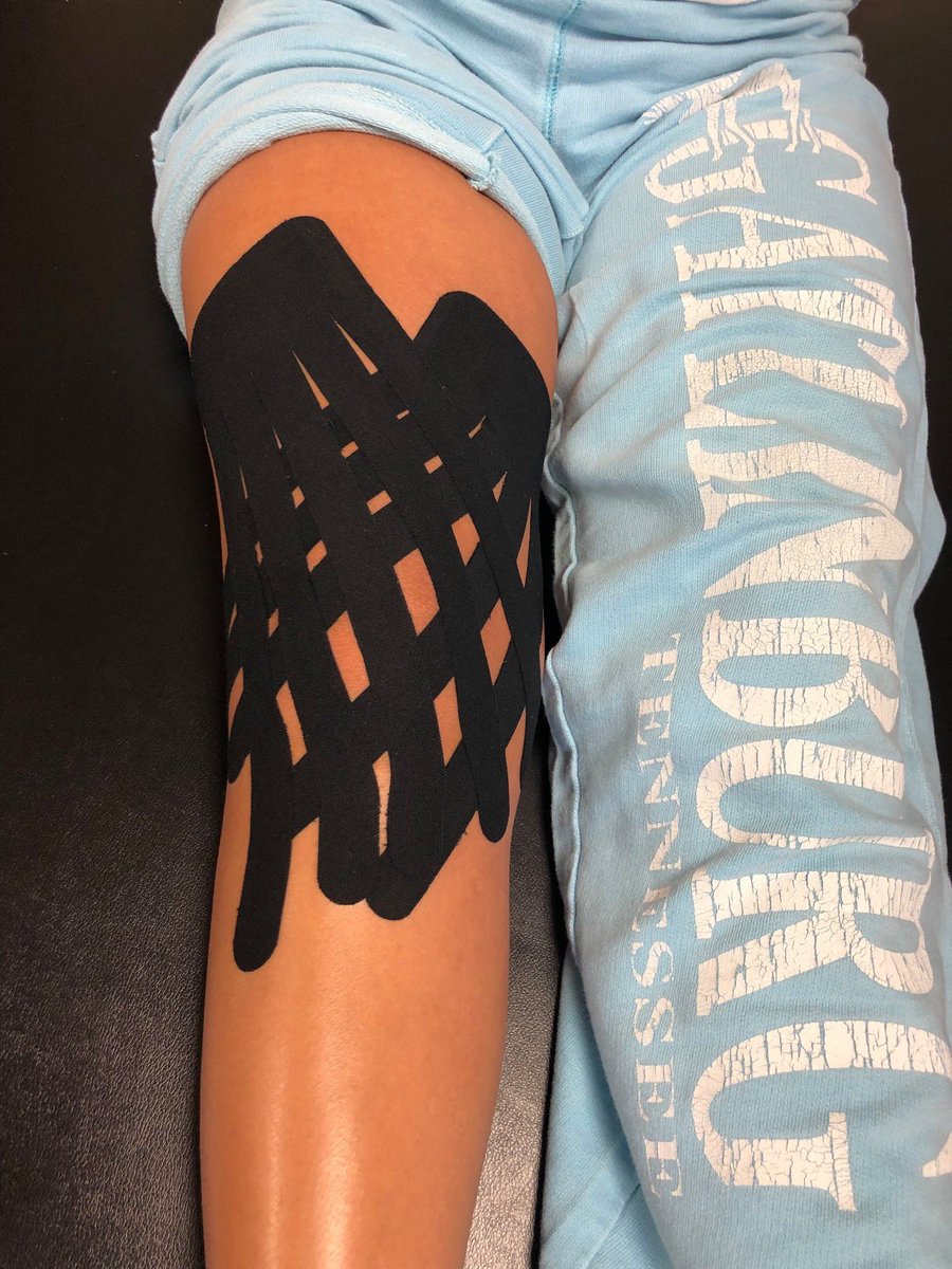 starpt4u's tweet photo. Lindsey is a patient at our #Cookeville clinic and has right #Knee #Pain and swelling due to a #KneeSprain. @Rocktape #Kinesiotape strips will reduce fluid from #Sprains and #Strains. Lindsey loves the tape! Great job Lindsey!
#PhysicalTherapy #PT #ChoosePT #STARPT #Tennessee https://t.co/bj8HDWWCtR
