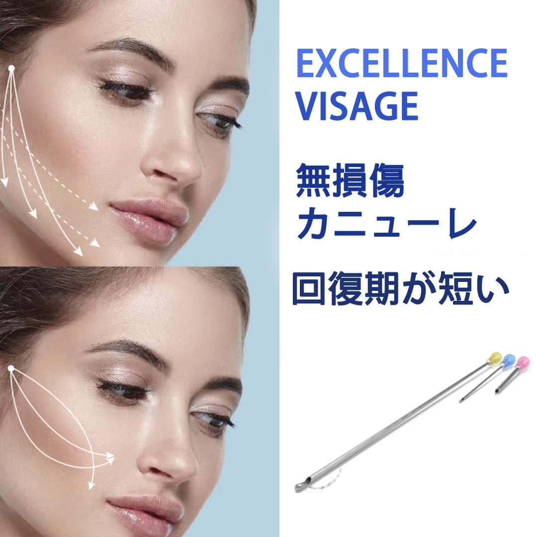 aptosjapan's tweet photo. スレッドリフトで使用する糸について
⠀
一般的にスレッドリフトに使用されている糸には、「溶ける糸（吸収性）」と「溶けない糸（非吸収性）」があります。 https://t.co/qgTkbTVA3i
