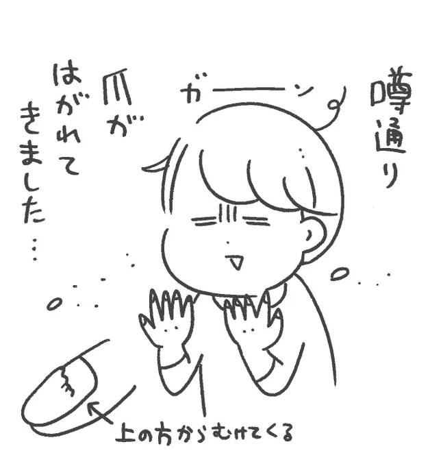 手足口病になってから2ヶ月… 
