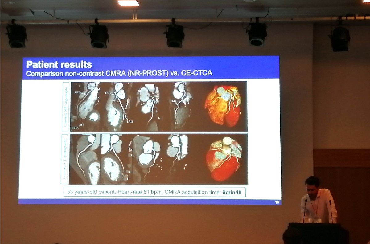 Excellent talks on cardiac and coronary MRA this morning at #SMRA19! With presentations from Professor René Botnar, Dr Haikun Qi, Giorgia Milotta, Dr Niccolò Fuin and Dr Aurelien Bustin. <a href="/KCL_CardiacMR/">KCL Cardiac MRI</a> <a href="/Giorgia_Milo/">Giorgia</a> <a href="/12Fuino/">Niccolo Fuin</a> <a href="/AurelienBustin/">Aurelien Bustin</a>