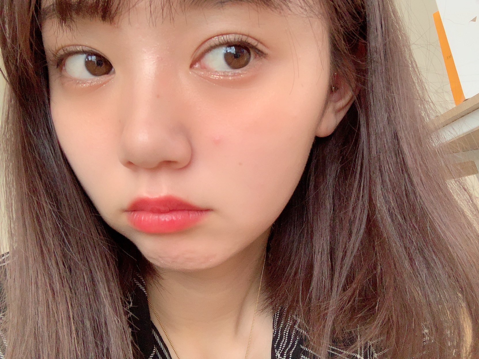 江野沢愛美 明日撮影なのに 珍しく大変なところにニキビが出来てしまったので Iseabeautylab さんでビタミン点滴とジェネシスしてもらいました 何してもどんだけ可愛い格好しても ポンコツ状態 笑 泣ける 笑
