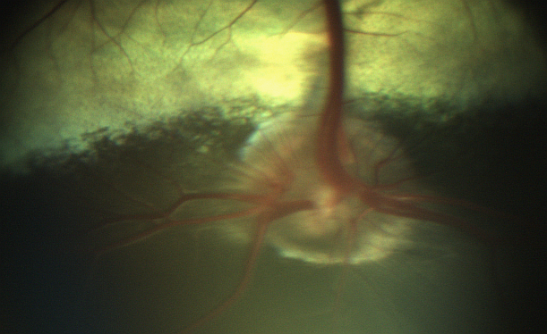 epipole_ltd's tweet photo. How did cows help us to look at neonates' eyes?
Find out at @biposa when @craigAtepipole talks about the crazy amount of engineering that went into #epiCam. 
#biposa #biposa19 #ophthalmology @RCOphth https://t.co/TBjdcoL7Db
