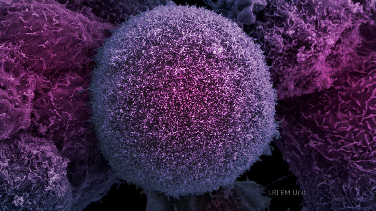 CR_UK's tweet photo. ‘Why do some cancer therapies stop working after so long?’
☝️Our latest #ScienceSurgery question. Check out our blog post for the answer 👉 https://t.co/D3sXdiskoY https://t.co/0oGRMiGrYa