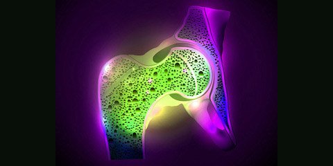 High-dose drug combo could be an ideal intervention for post-menopausal #osteoporosis...but it's 💰. ms.spr.ly/6014TOkpk