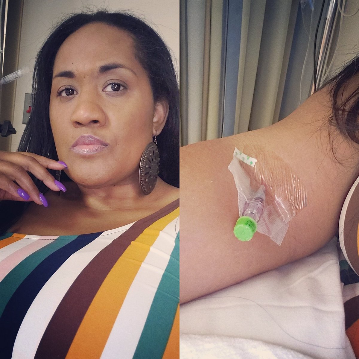 IncStomp's tweet photo. Inhale....poked twice and 5 hours later...my infusion is done. Exhale
MS is no joke, it's a bitch. I don't wish this disease on my worst enemy. We need a cure. #MSDiva #CureMS #MSSucks #HSCT #SaveShavonne #Donate #StopMS #StompOutMSInc #KissMSGoodbye #MyLife #MSWarrior #Help https://t.co/SfJGyppDnt