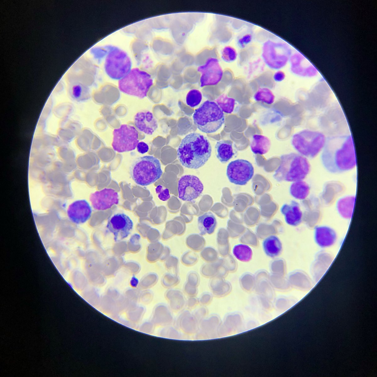 GiRinaldini's tweet photo. Tweet de apreciación a la mitosis: 💉🧪🧬 https://t.co/8A0FeOq2dt