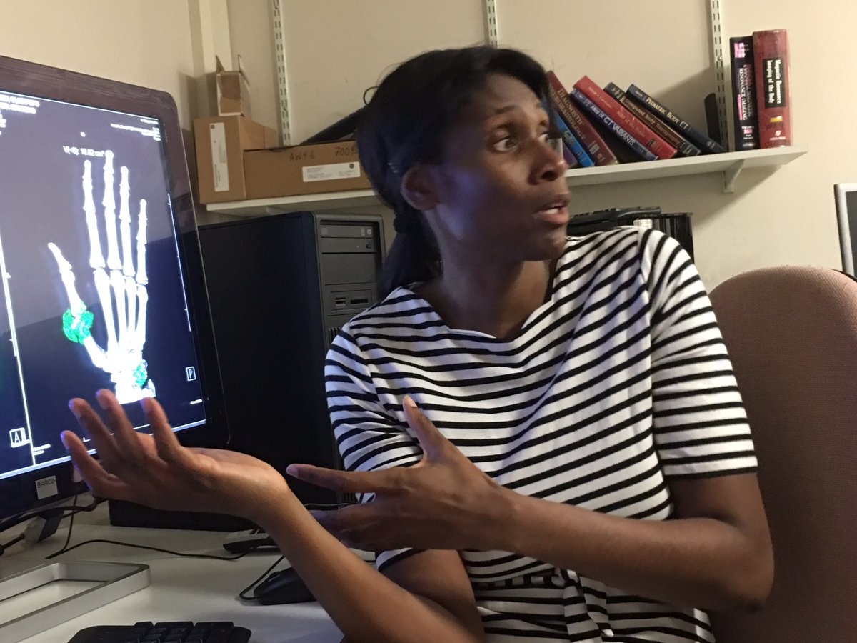ShamimUmarji's tweet photo. Super Hand MDT 2day - dual energy CT for diagnosis of gout . Brill service from radiologists @StGeorgesTrust #radiology #NHS #nevertooldtolearn s https://t.co/nG3bZ7A1bg