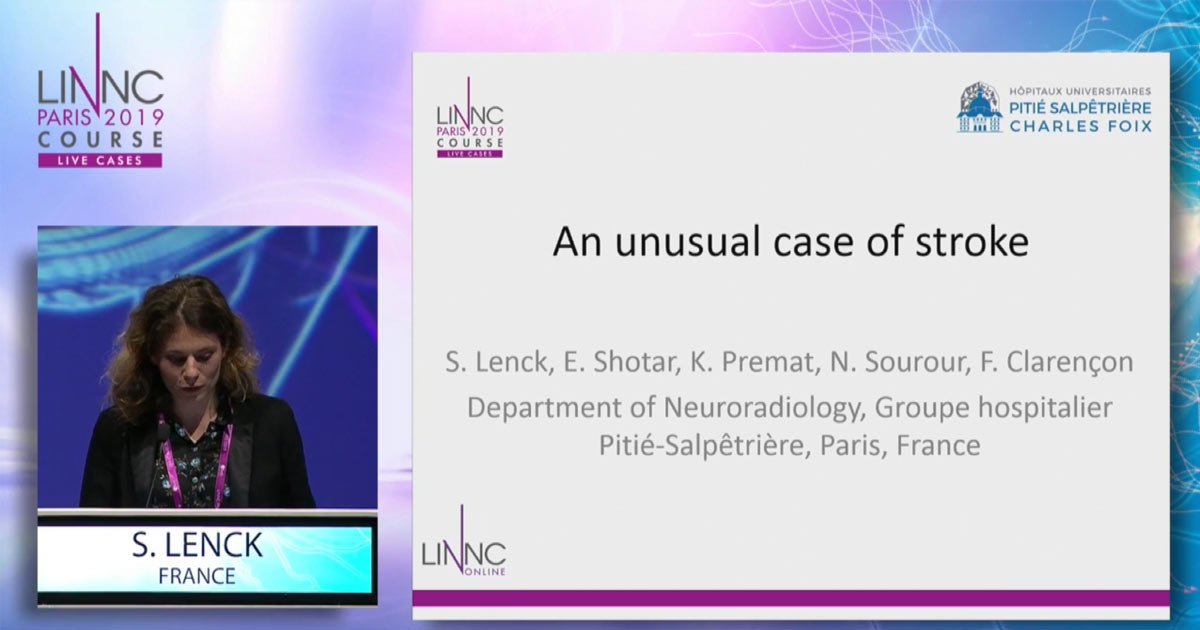 Want to view a very unusual case of #stroke ? 
Stéphanie Lenck presents the case of a 46-year-old patient who had a TIA with transient left-sided hemiplegia three days prior to admission.
Did you already have to treat such kind of unusual #stroke ?
ow.ly/V3nN50vbel0
