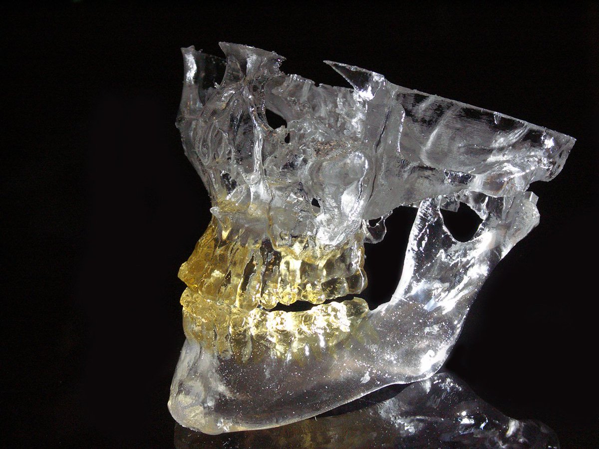 PDR_SPD's tweet photo. Enter our design challenge. Open to applicants from India https://t.co/qAA5HfrYdq #India #ukieri @kgmulucknow @UKinIndia @inBritish @NewtonFund @indiaDST @DBTIndia @iitdelhi @iitbombay @wipro #design #3Dprinting #maxillofacial #craniofacial #resourceefficiency #prosthetic https://t.co/7RcqKsZQv7