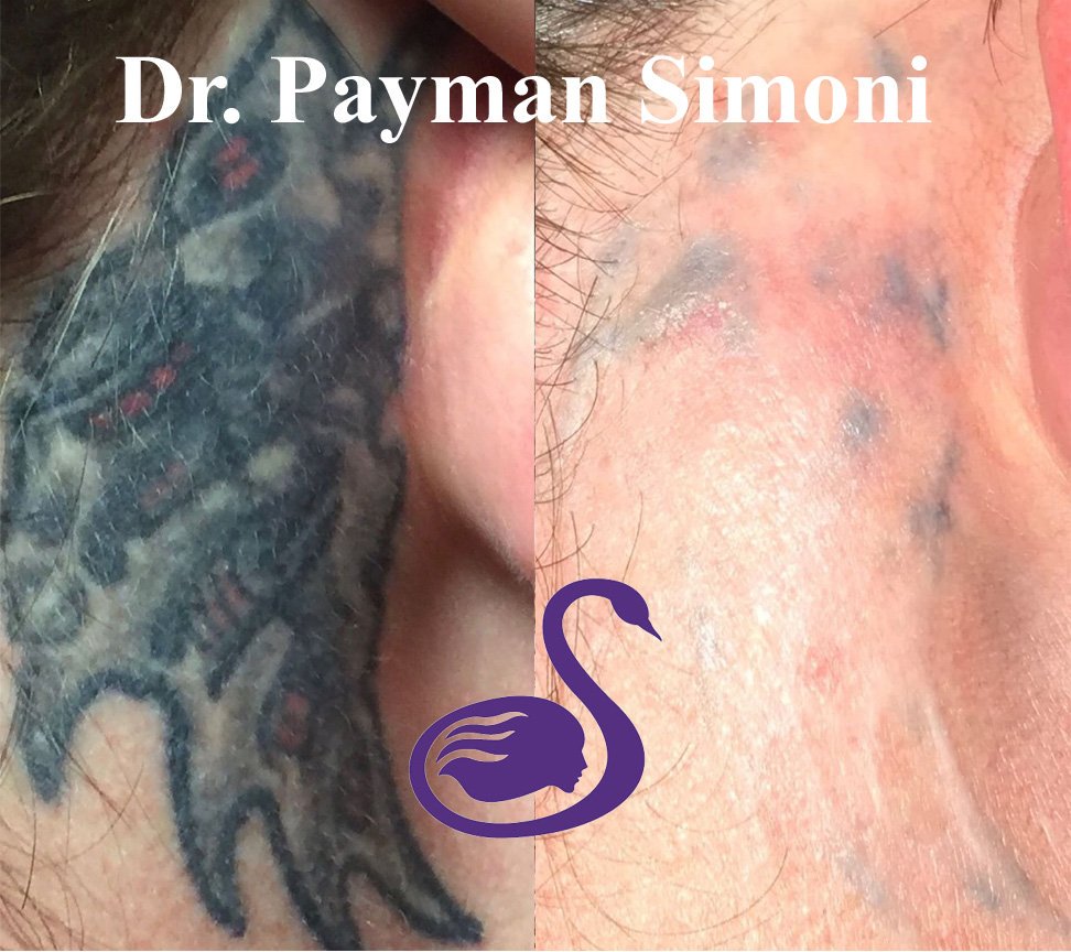 Payman_Simoni's tweet photo. With Dr. Simoni you get results - 310-360-1360 https://t.co/BcOlj8OgWS