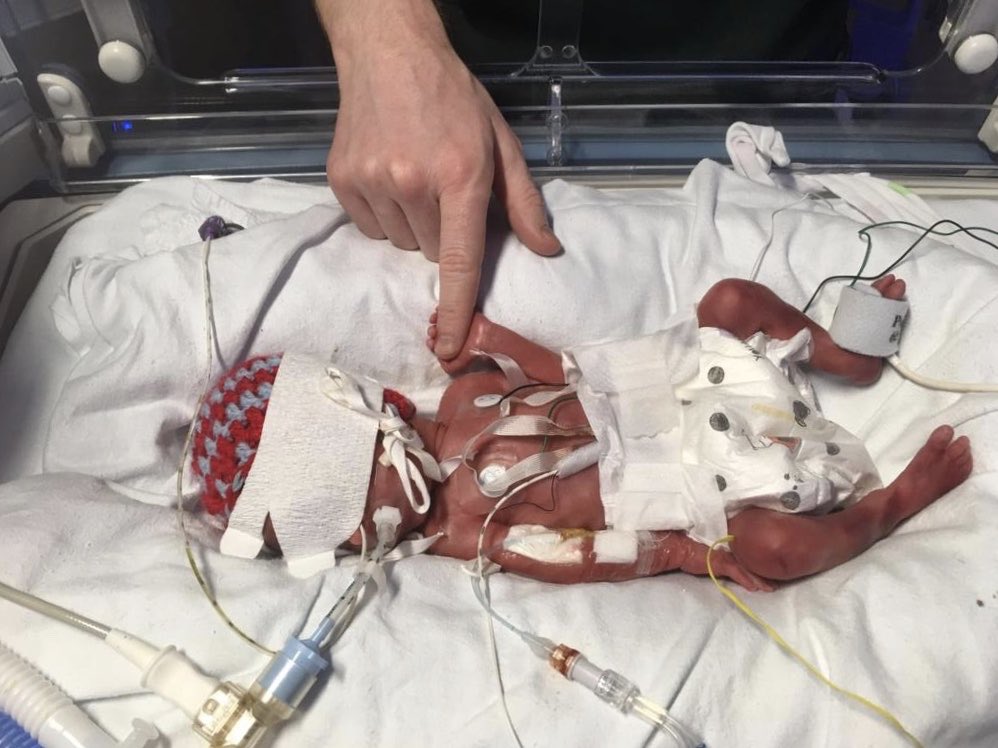 Sandy, Rin and I are joining Janey Brant to Race the Sun in the Lake District. We’ll cycle 80km, climb Helvellyn and canoe 3000m within 12hrs. Janey’s son was born at 27weeks and survived thanks to ⁦<a href="/actionmedres/">Action Medical Research</a>⁩. Donations welcome justgiving.com/fundraising/so…