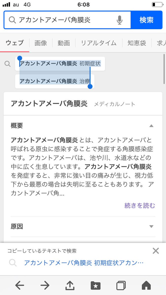 野村俊一 On Twitter 女子大生 が半年間 コンタクトレンズ をつけっぱなし アカントアメーバ角膜炎 にかかり 失明 の危機 微生物に角膜を食べられる危険な病気 誰でもかかりうる病気 残業や用事で帰宅が遅くなり10時間 12時間と長時間つけたままにしている