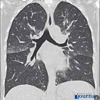JournalARG's tweet photo. “Avances en Diagnóstico por Imágenes” es una publicación oficial del Colegio Interamericano de Radiología (CIR) y contiene ejemplos como estos.

Encontralo en https://t.co/YmcblLqWe0 https://t.co/YD6ReMtEgu