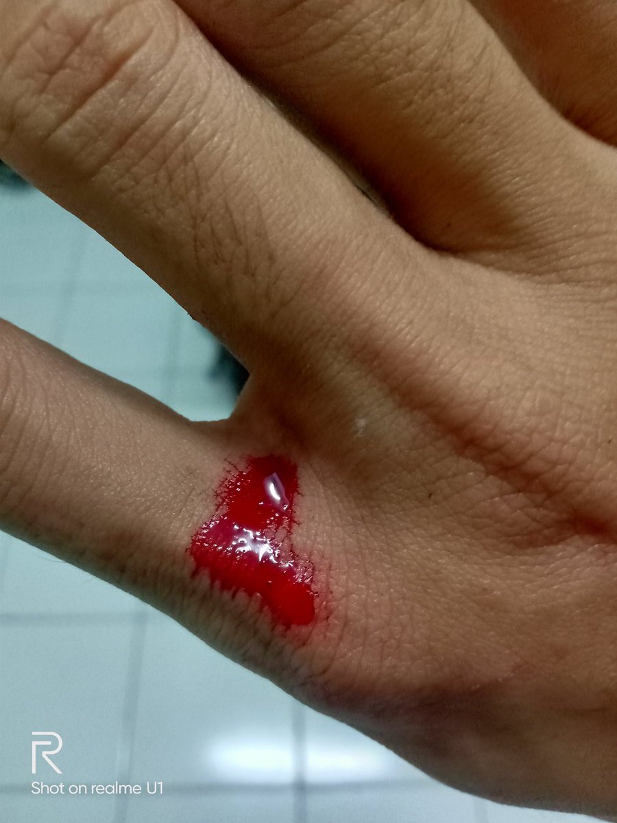 kiyan22's tweet photo. Gesekan dengan lempeng bumi https://t.co/lQY0rtVtxU
