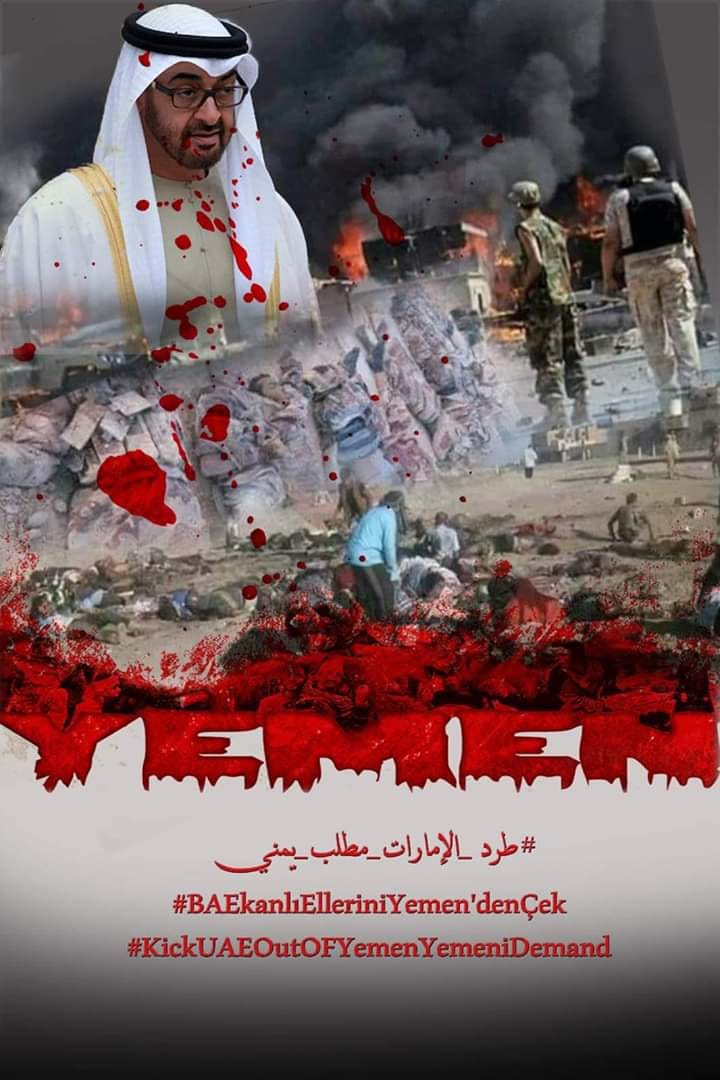 هذي الدماء لن تروح هدر #طرد_الامارات_مطلب_يمني
