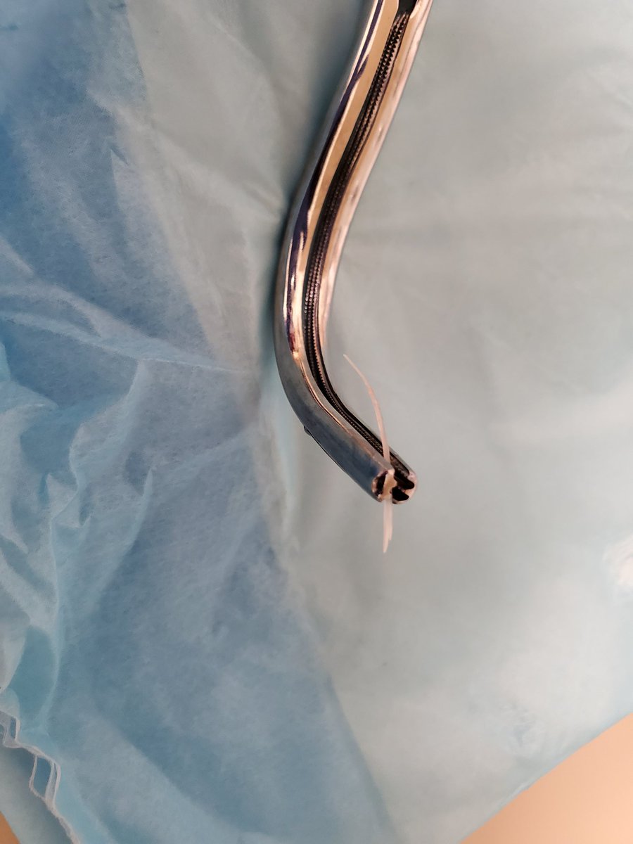 BianaLanson's tweet photo. Another exciting Friday @stamfordENT! Dr. Neubauer and Dr. Lanson took out a fishbone from the vallecula of an awake patient. No trip to the OR necessary! @StamfordHosp https://t.co/UcJxzhp9nC