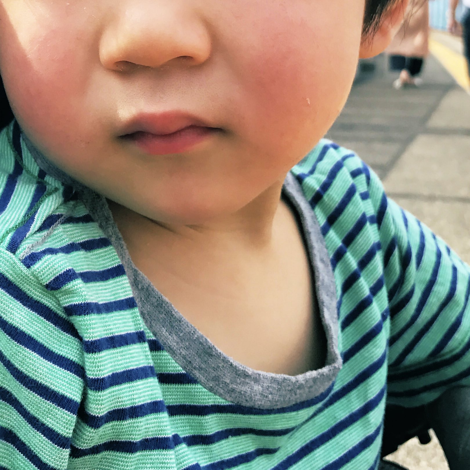 べった 5歳と3歳と6m 息子 昨日の夜からずっとほっぺがまっかかなんだけどりんご病か ほっぺが赤くなる7 10日前に風邪の 症状があるって書いてあったけど お盆 16日 約2週間前 の発熱がそれかな 違うかな T Co U6jf9wxjyp Twitter