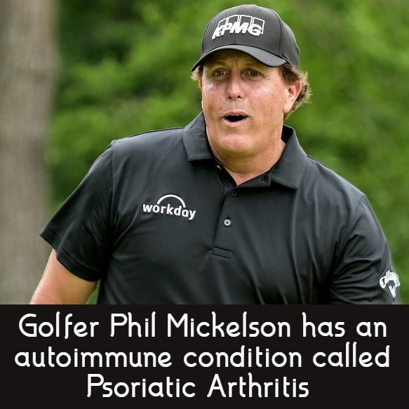 MAutoimmune's tweet photo. Pro Golfer Phil Mickelson has an autoimmune disease called Psoriatic arthritis. For more info on the condition, please follow the link below

https://t.co/wSc99q1Hxs

#psoriaticarthritis psoriaticarthritiswarriors #chronicillness #autoimmune #autoimmunedisease  #mrautoimmune https://t.co/E8xxzyguea
