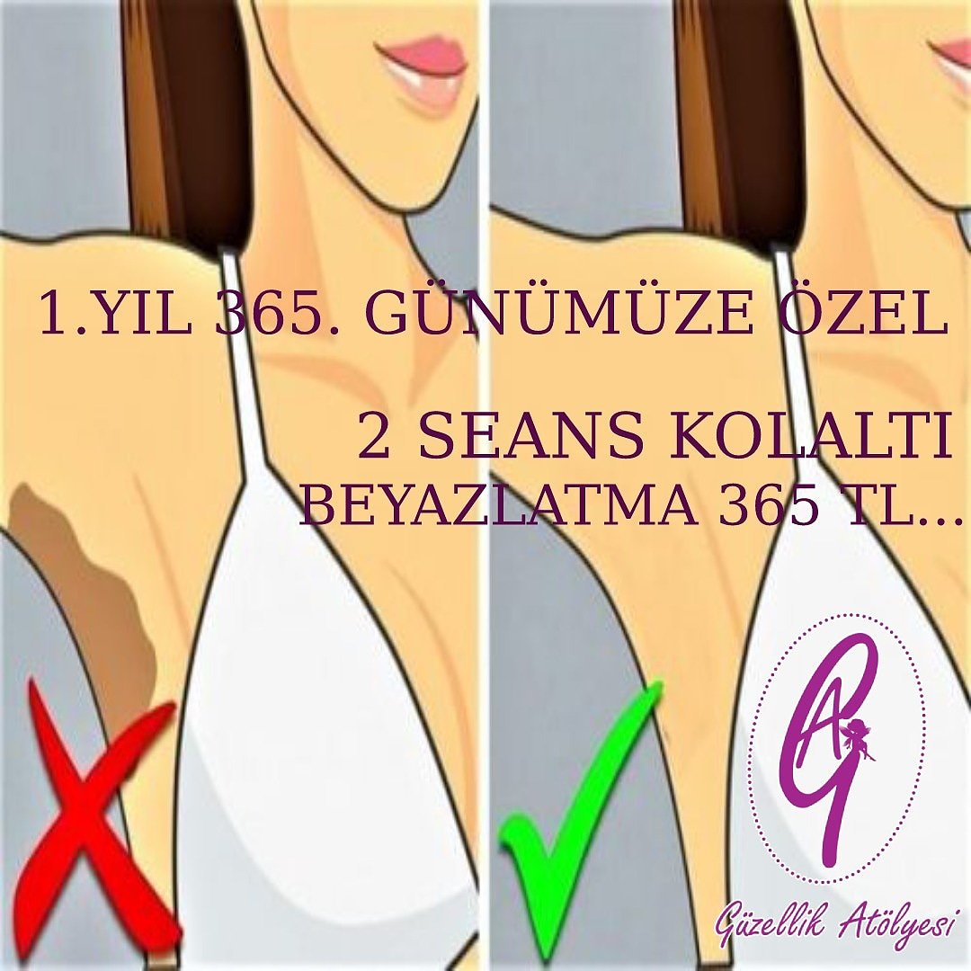 1 EYLÜL KURULUŞ YILDÖNÜMÜMÜZE ÖZEL '365' TEMALI  KAMPANYALARIMIZ...30 EYLÜLE KADAR GEÇERLİDİR...
#guzellikatolyemiz #kampanyalıürünler
#campaign #kampanya #cvitamini #ciltbakımı #leke #leketedavisi #lazerepilasyon #bikini #seans #yıldönümü #kuruluş #kolaltı #beyazlatma #hediye