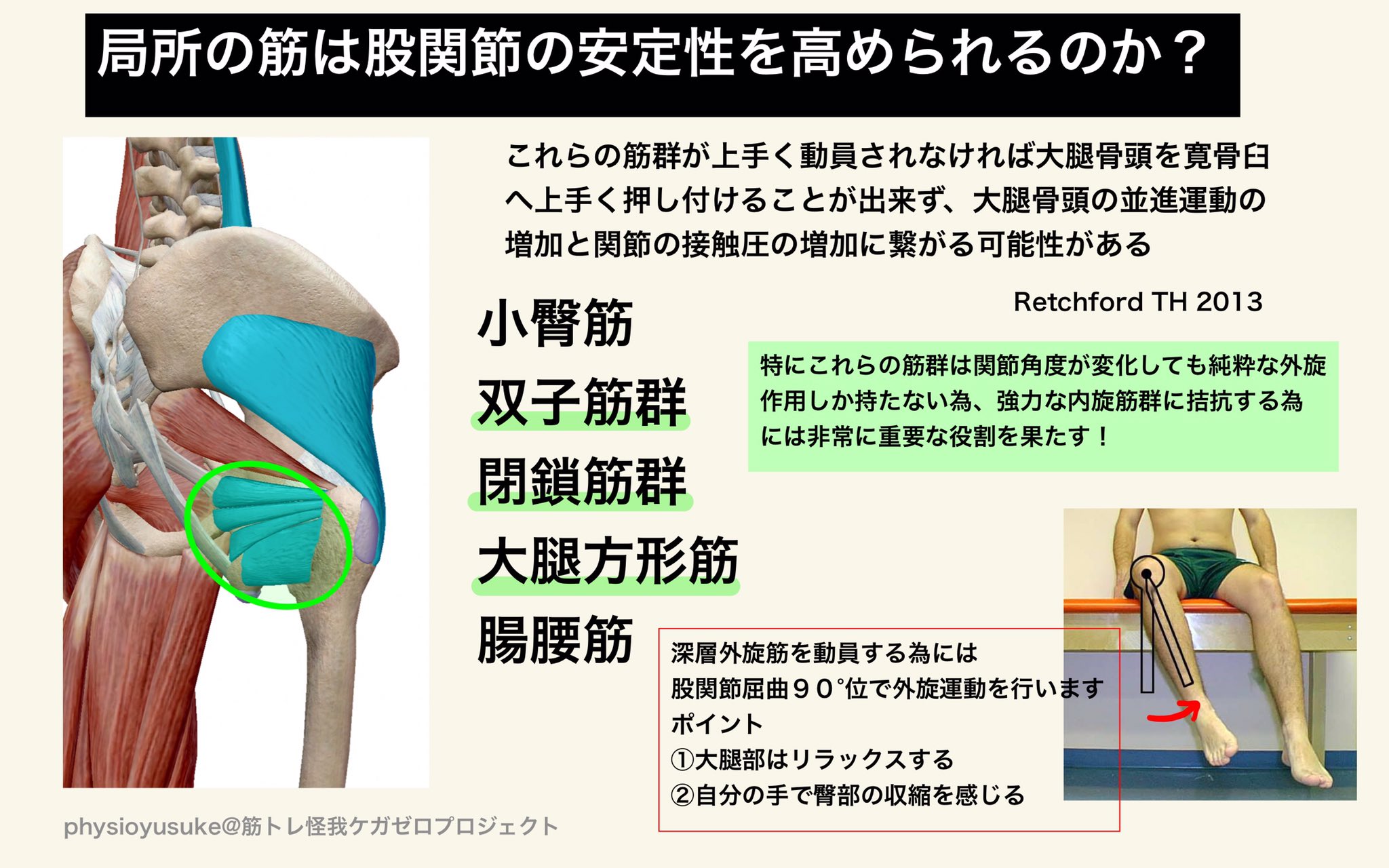 ユウスケ 筋トレ怪我ケガゼロプロジェクト 新記事投稿 股関節が痛い その原因グラグラかも 股関節が痛くてストレッチするけど治らない それは不安定な股関節をさらに不安定にしています 後方外旋筋は 股関節屈曲時等に適度な硬さにより ユウスケ 筋トレ怪我ケガゼロプロジェクト 新記事投稿 股関節が痛い その原因グラグラかも 股関節が痛くてストレッチするけど治らない それは不安定な股関節をさらに不安定にしています 後方外旋筋は 股関節屈曲時等に適度な硬さにより