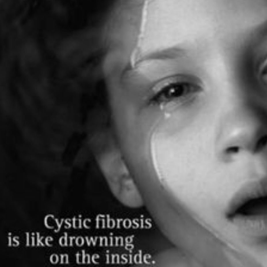 myCFHero's tweet photo. @NHSEngland Hugely insensitive to brag about saving money on medicines when children in this country are being left to suffer & die with #CysticFibrosis, instead of receiving commercially available #LifeSavingMeds4CF like #OrkambiNow -Eur/Scot/Irish peers have access-are we #LeadingInHealth https://t.co/lMJfAroVJZ
