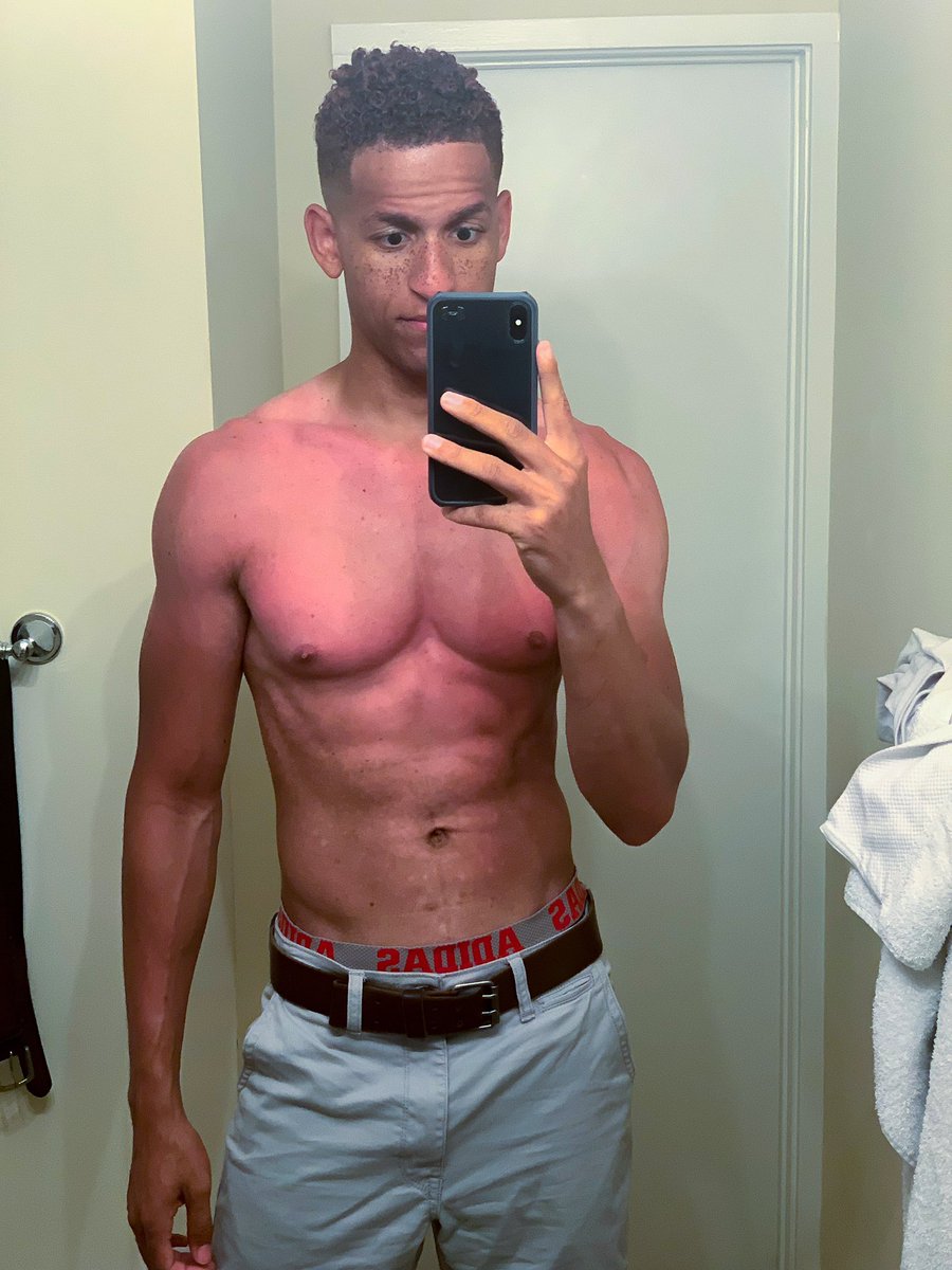 nerush24's tweet photo. Vacation sunburn is in FULL EFFECT!
#vacation #beach #LaborDayWeekend  #sun #funny #LaborDay https://t.co/ud4N5ghv1h