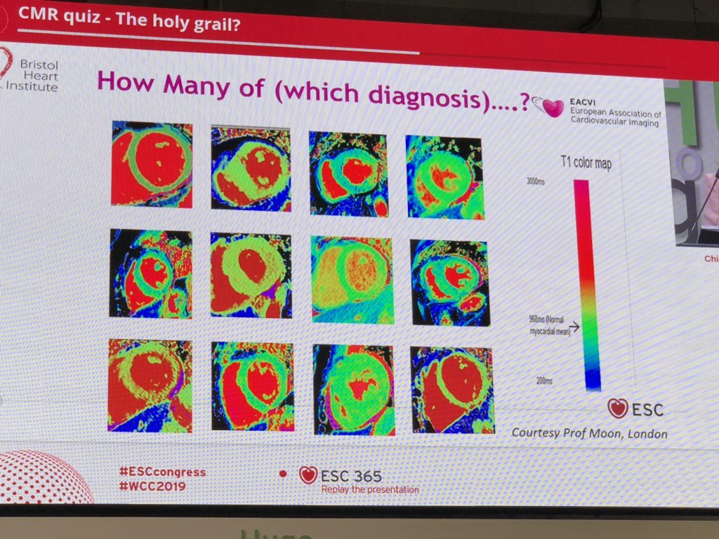 iamritu's tweet photo. How many #Fabrys disease #whyCMR T1 mapping by @chiarabd & @JccmoonMoon #ESCCongress @cshenoy3 @afshinfarzan @Doc_Tiger https://t.co/XRm4RfOkpe