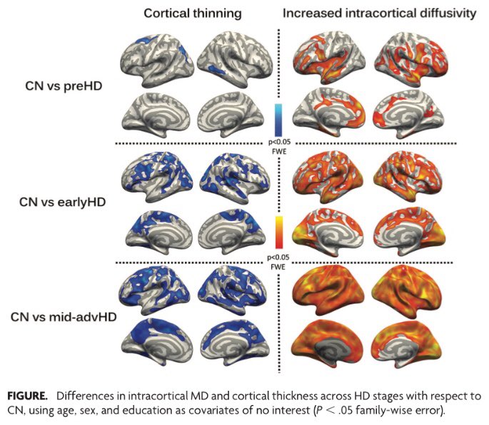 Saul Martinez Horta Patapam Y Con Pdf Gratis Tu Widespread Increased Diffusivity Reveals Early Cortical Degeneration In Huntington Disease Huntingtonsdisease T Co Efq2he6hsz Pdf T Co Ugya48xaxt T Co