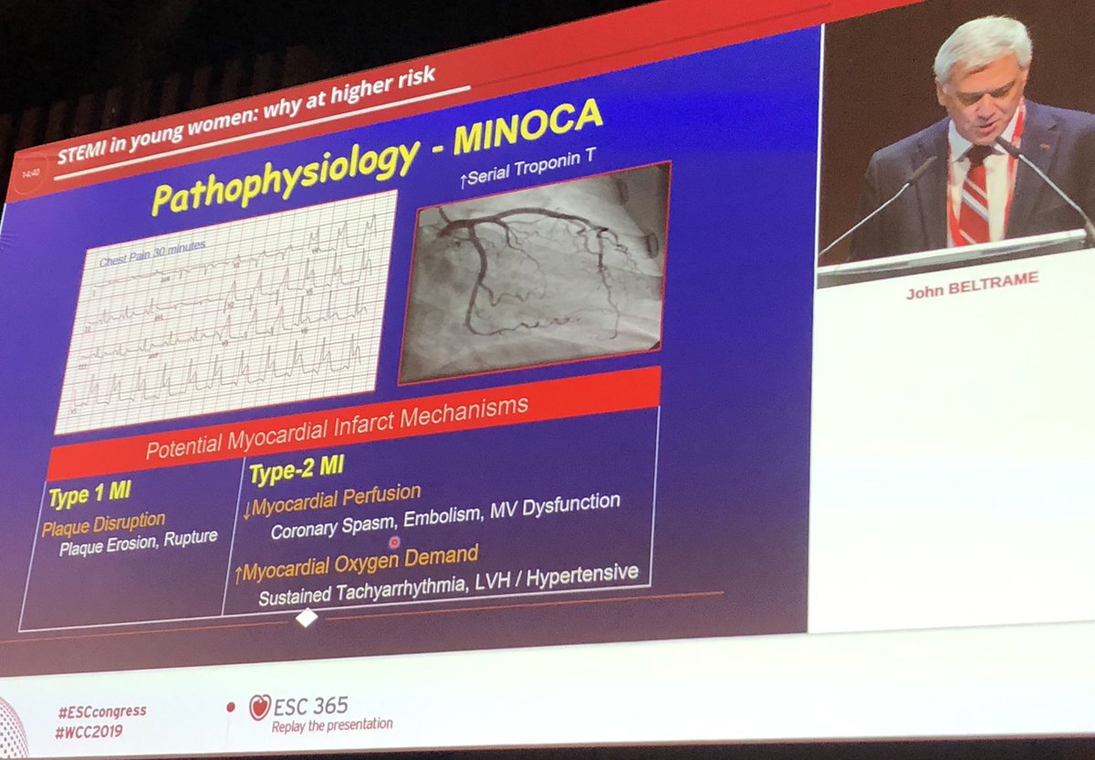 <a href="/beltrame_john/">John Beltrame</a> speaking at #ESCcongress2019 showing poor outcomes for young #women with #STEMI are multi-factorial. Women are also over-represented in #MINOCA....More #gender focused research is needed <a href="/TharshyP/">Tharshy Pasupathy</a> <a href="/msclabrosciano/">Dr. Clementine Labrosciano</a> #ESCCongress