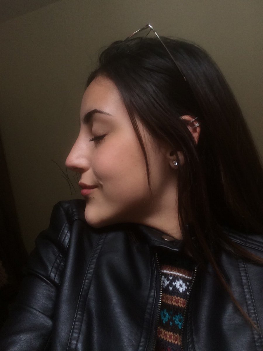 Naa_borges1's tweet photo. Rinoplastia👃🏻✨ https://t.co/vNlO7wWbfP