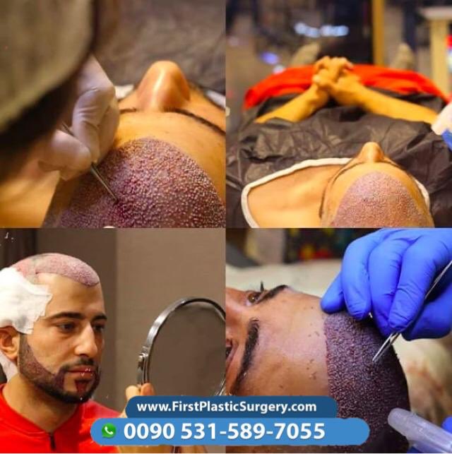 CosmeticsTurkey's tweet image. 💪🏻Everything is possible with us💪🏻 Contact us via Viber/WhatsApp 🇸🇦🇹🇷🇫🇷🇬🇧🇩🇪🇳🇱
📞00905315897055 ☎
firstplasticsurgery.com
😍😍🇹🇷🇹🇷😍🇹🇷😍🇹🇷😍🇹🇷🇹🇷😍😍🇹🇷😍😍
#facelift #cosmeticsurgery #confidence #selfconfidence #antiaging #naturalresults #eastcoastplasticsurgeon #bostonplasticsurg