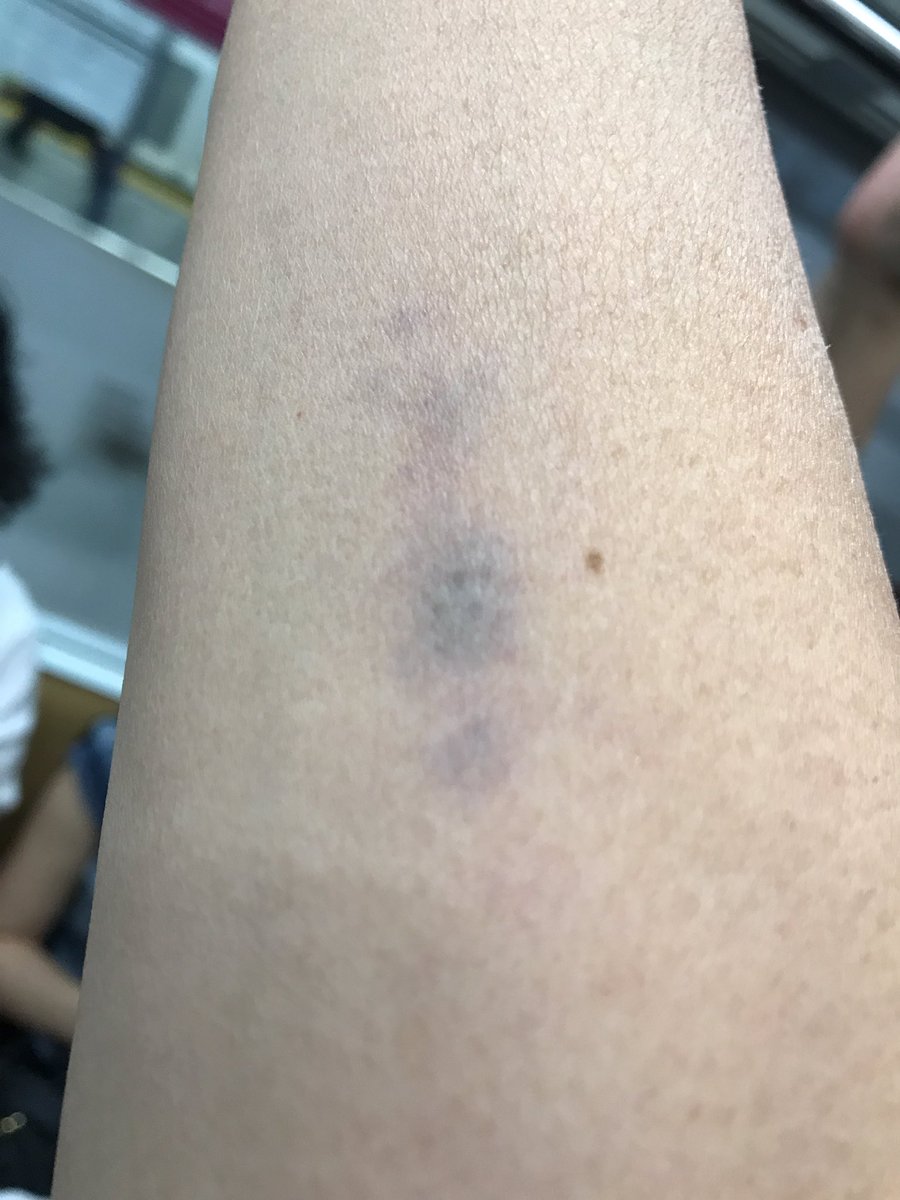 ユキ ラインハート ありがとうございます ユキ ラインハート ありがとうございます