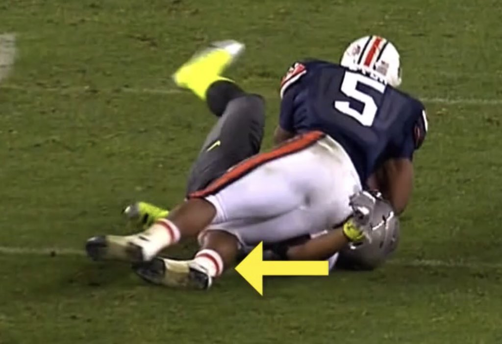 mel_harmon00's tweet photo. @AZSko2 @CollegeGameDay How about I show you his ankle down. https://t.co/BHCMGvUDo3