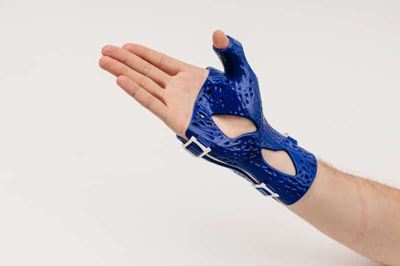 3dheals's tweet photo. Just published! #ExpertCorner #3DHEALS What does it take to bring #3Dprinting to “#mainstream” #healthcare? Lativa's #Castprint @cast_print https://t.co/CPDFZvvC76 https://t.co/aL3QTtkDmG