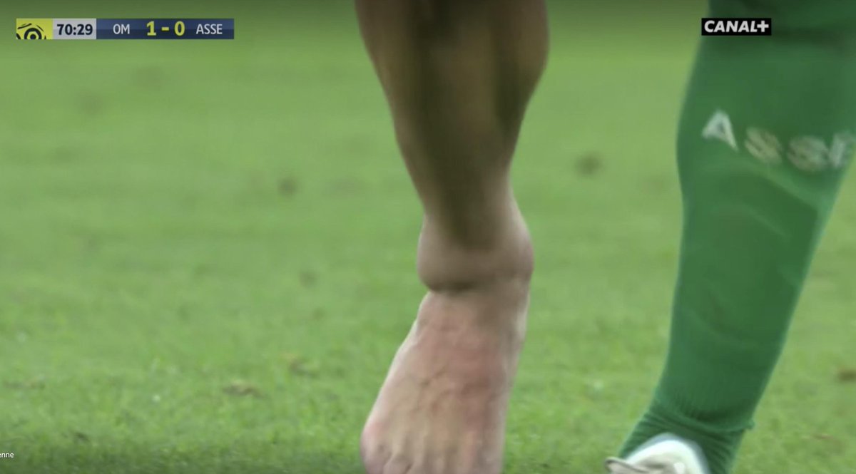 Maxifoot Actu Foot Et Mercato On Twitter Cest Quoi ça