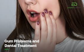 salma_357's tweet photo. Gum Problems....huh???😮😬 Everyone is confronting this problem.... gums play an important role in smiling. Problems in gums make you feel less confident. To seek remedy..... please access the below ste of Glasgow
https://t.co/ePYjGPm2l3
#dentalproblem
#gumproblems
#causes https://t.co/h0P0cgNQBd