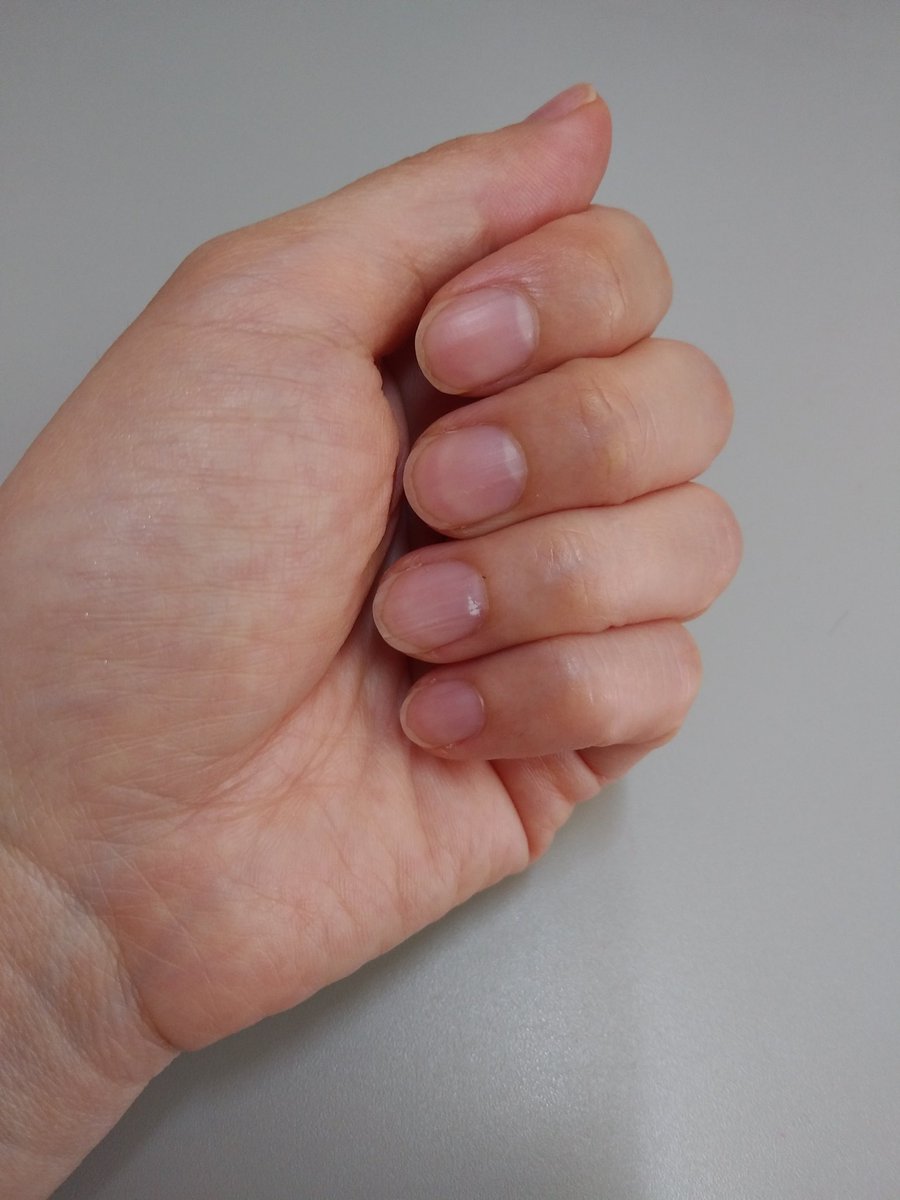 Uzivatel ヤマサキサチコ Na Twitteru 薬指の爪に白いもの 何かいいことありそな予感 爪に白い点 白い星 爪 薬指