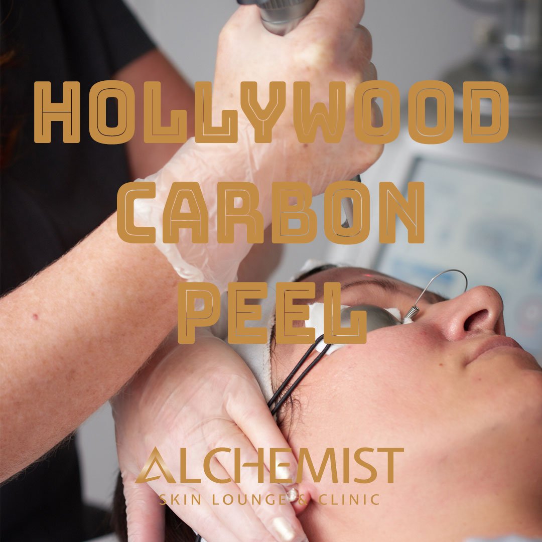 alchemistVandyk's tweet photo. Peel away your worries with the #HollywoodCarbonPeel using our incredible #SpectraXT laser. This non-chemical peel rejuvenates your skin, builds collagen and evens texture and tone. With NO PAIN, NO DOWNTIME and for ALL SKIN TYPES, what’s not to love?! #sheffieldissuper https://t.co/PX1NWiMeLC