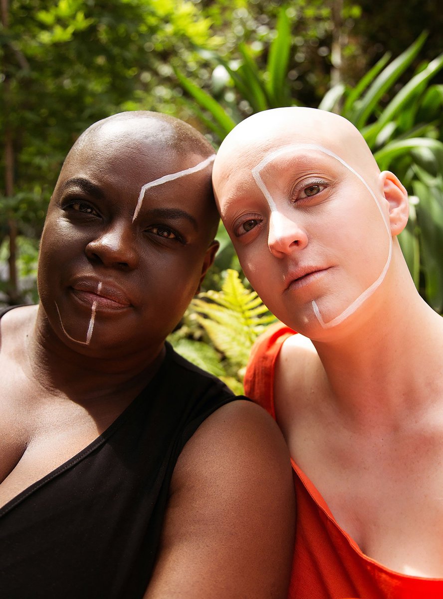 This powerful shoot by <a href="/Ally_Alopecia/">Ally</a> for International Alopecia Awareness Month, shows that bald is beautiful, and that our hair is not our crown and glory.

r29.co/2jU7etn