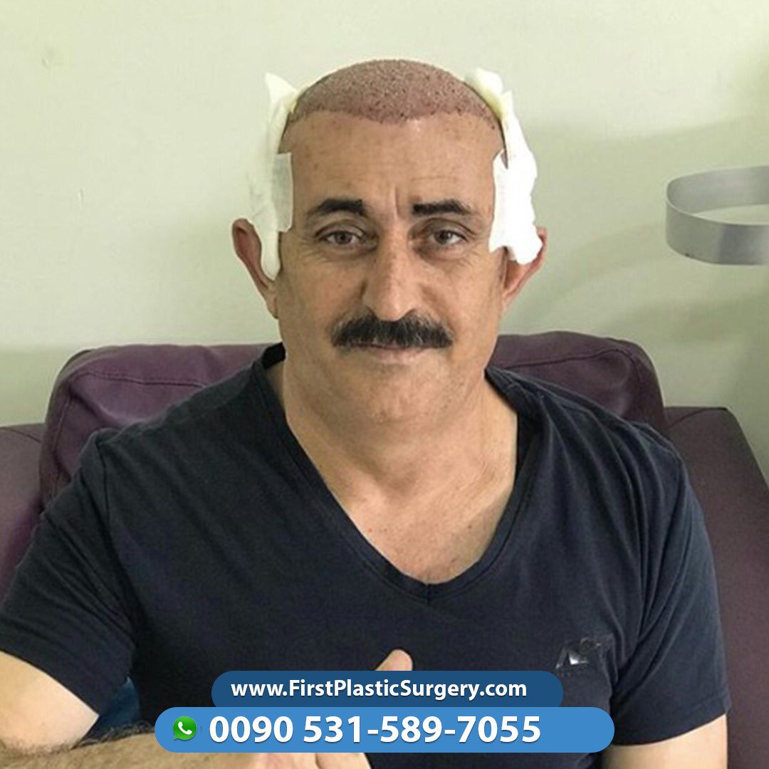 CosmeticsTurkey's tweet image. Our results are unmatched by unique results and prices💪🏻🥰 Contact us via Viber/WhatsApp 🇸🇦🇹🇷🇫🇷🇬🇧🇩🇪🇳🇱
📞00905315897055 ☎
firstplasticsurgery.com
😍😍🇹🇷🇹🇷😍🇹🇷😍🇹🇷😍🇹🇷🇹🇷😍😍🇹🇷😍😍
#facelift #cosmeticsurgery #confidence #selfconfidence #antiaging #naturalresults #eastcoastplasticsu