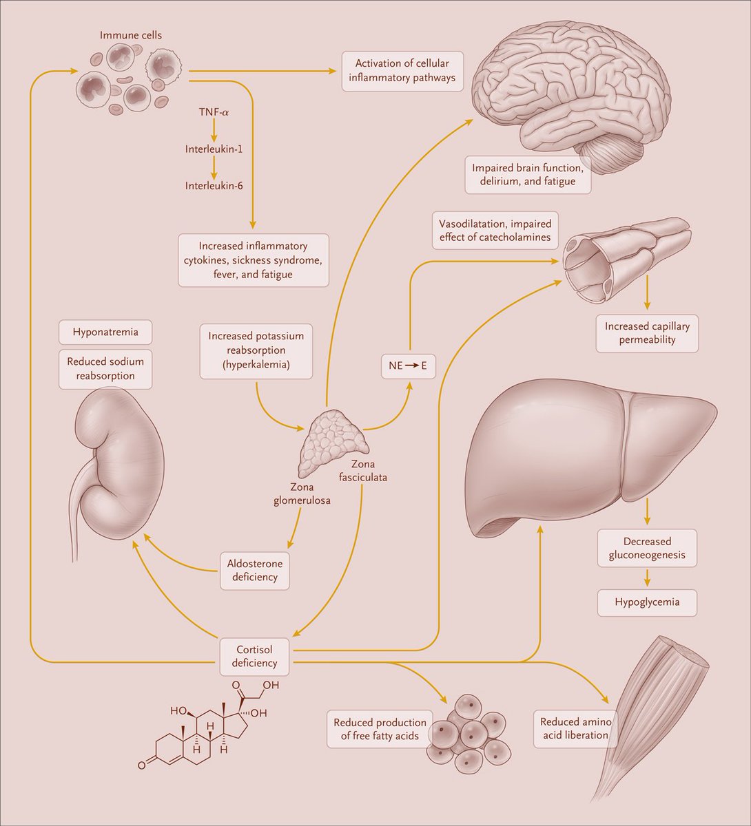 NEJM's tweet photo. Clinical Pearls &amp; Morning Reports: Adrenal Crisis https://t.co/HDE09rUP1p via @NEJMres360 https://t.co/wdbsmlu5pm