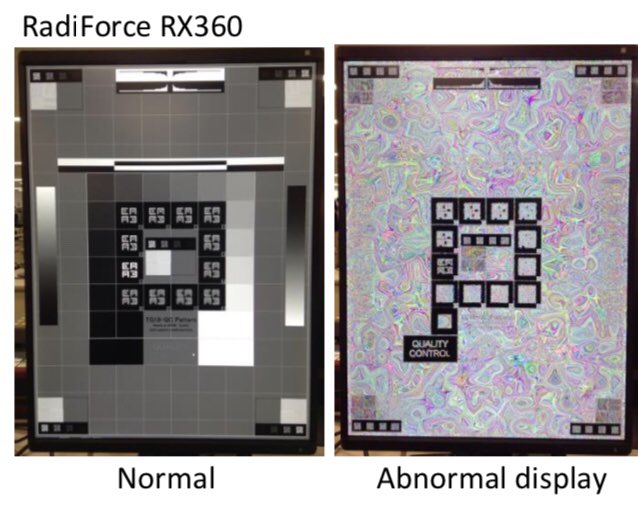 SafeHealthTech's tweet photo. [Eizo]
[Rx360, Rx560R]
ظهور هذه الاشكال "الرخامية" كلما تحولت هذه الشاشة الطبية الى نمط الخمول مما قد يؤدي الى تأخر التشخيص! تواصل مع المصنع للتحديث

تاكد
https://t.co/1JzCDrDgjL

#أجهزة_طبية_آمنة #Safe_Care #PatientSafety #سلامة_المرضى https://t.co/VL5PzRfWw5