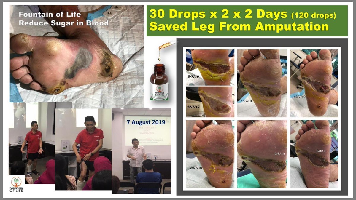 My wife and I just became independent distributors of Fountain of Life - no medicine or cure, but preserves and prevents. Look what it did! fol.one/lucican