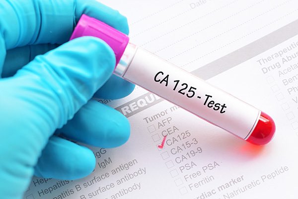 MIOvarianCancer's tweet photo. A message from our founder, Pam Dahlmann. “I lost my maternal grandma in 1971 &amp; my mom in 2011 to ovarian cancer. It is almost 50 years later &amp; there is still no diagnostic test! Many wonder why the CA-125, Cancer antigen 125 blood test, can’t be used” https://t.co/szCLahQKMQ https://t.co/ZtbtWTl2YS